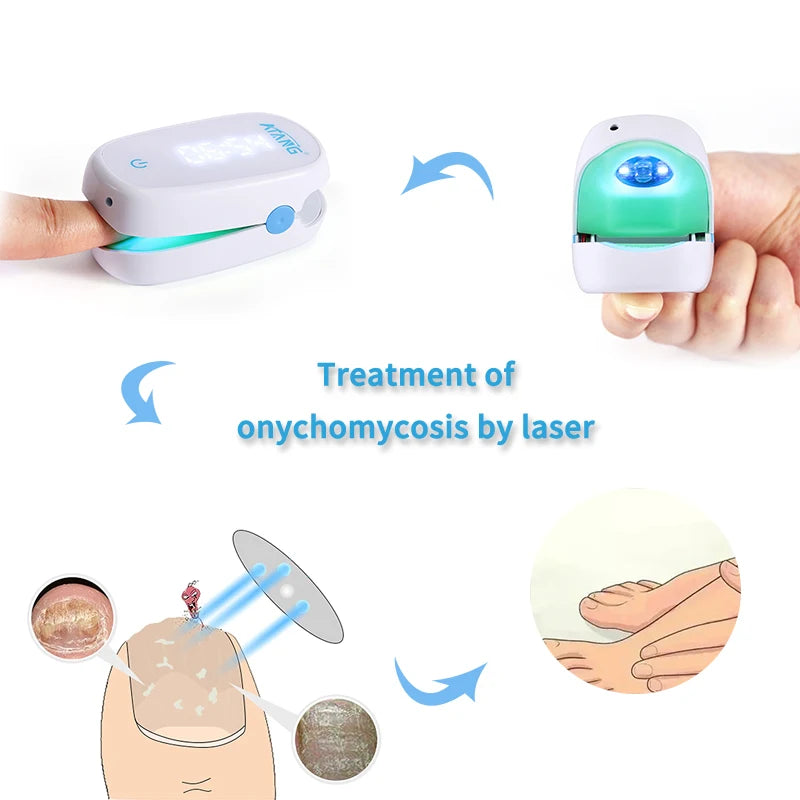 Cold Laser Treatment Appliance